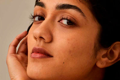 How to Fade Summer Pigmentation and Dark Spots (Fast!)