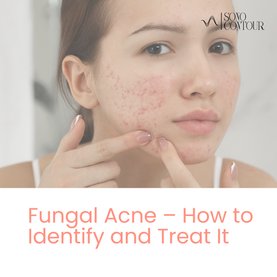 Fungal Acne – How to Identify and Treat It